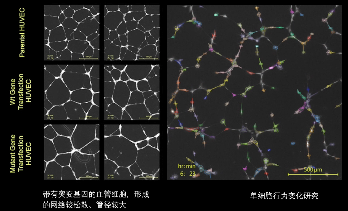 6、血管分析.png